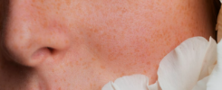 Skin Care: i nuovi Trend 2026 per la cura della pelle 3 Skin-Care-i-nuovi-Trend-2026-per-la-cura-della-pelle